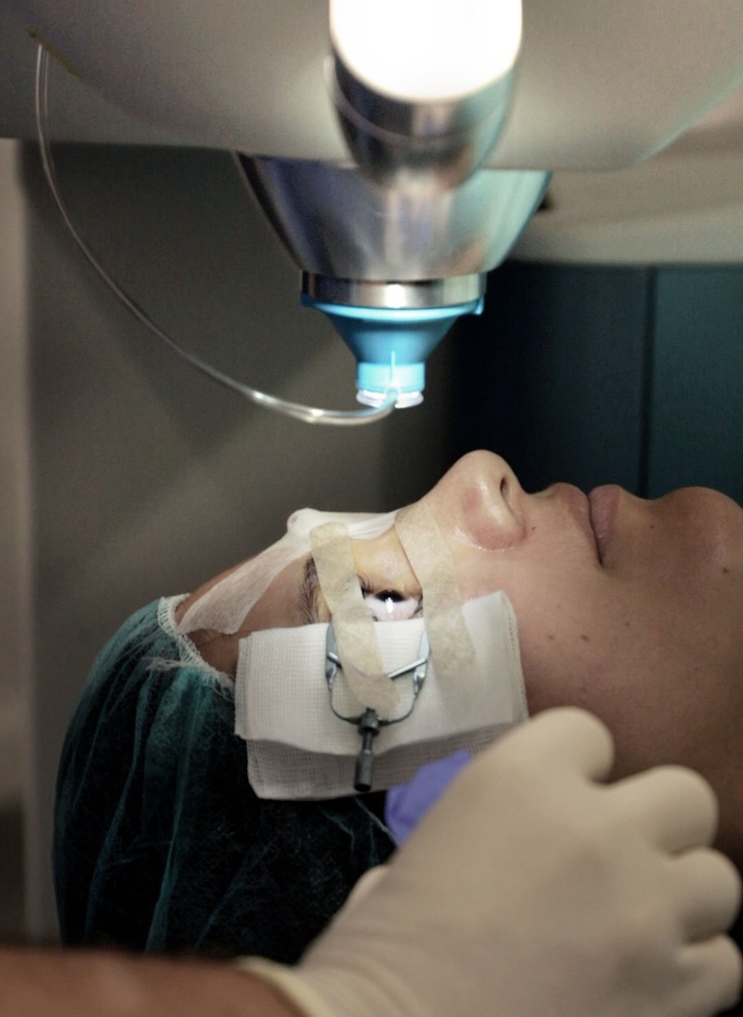 cirugía refractiva quirófano