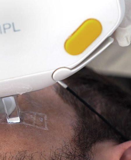 Tratamiento ojo seco IPL