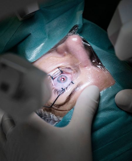 tecnicas-cirugia-refractiva